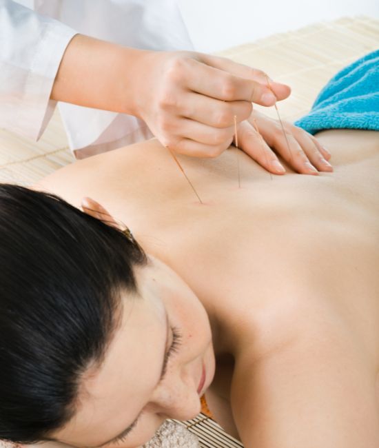 Acupuncture Experts in Abbotsford