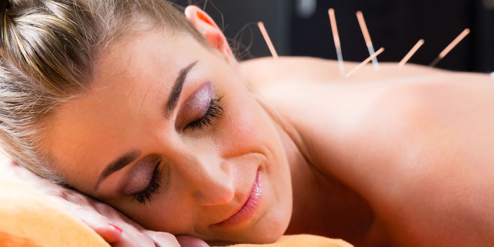 Acupuncture Treatments in Abbotsford