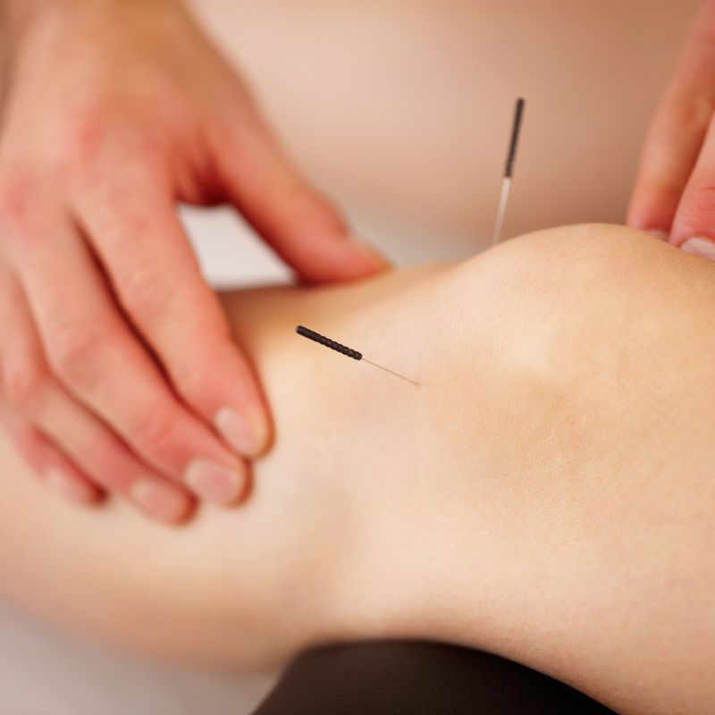 Discover Acupuncture Solutions in Abbotsford